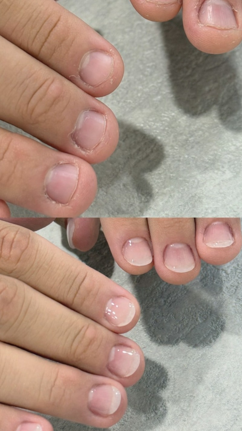 男士們，別再讓「咬指甲」拉低您的專業形象！